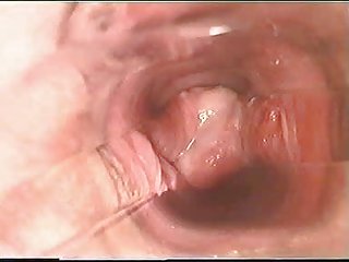 សិ vidio ម្តាយនិងកូនប្រុសនៅខាងក្នុង pussy រតាមរយៈបុ l៧ លែកពេលវេលា